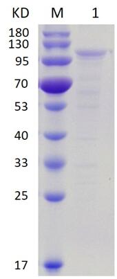 12% SDS-PAGE analysis profile of purified Rat Smarca4 (CBB stained).